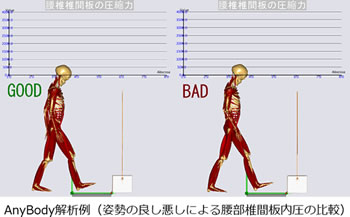 AnyBody解析例（姿勢の良し悪しによる腰部椎間板内圧の比較）