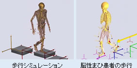 歩行シミュレーション・脳性まひ患者の歩行